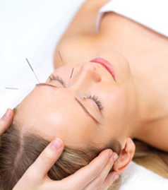 Acupuncture